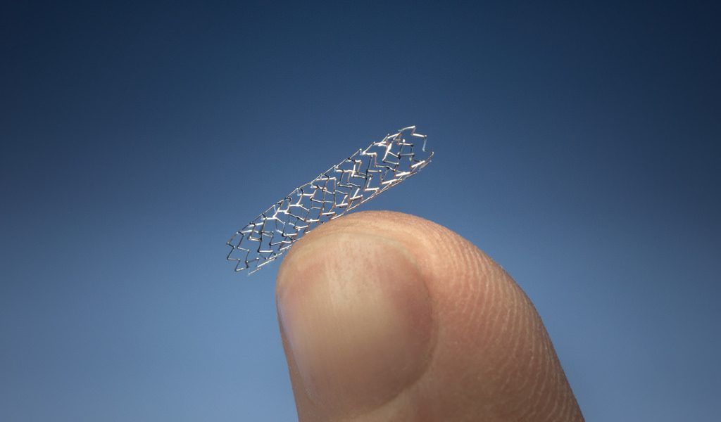 Hartstents (Stent)