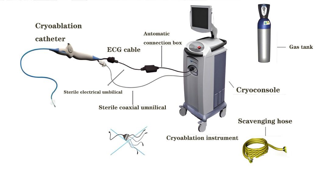 Basisonderdelen van een Cryoablatiesysteem