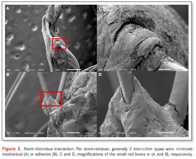 Stent-trombus interactie