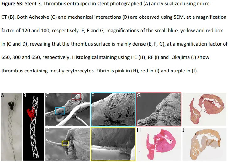 Thrombectomie stents